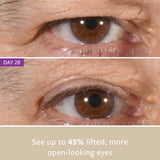 non-surgical EYELID LIFT freezeframeau