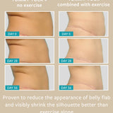 TUMMY TUCK freezeframeau